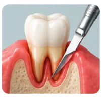 Mouth Ulcer Biopsy and Early Cancer Diagnostics in Varanasi